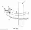 Fig. 20 - Method and apparatus for passing suture through tissue