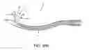 Fig. 44 - Method and apparatus for passing suture through tissue