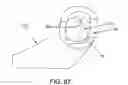 Fig. 66 - Method and apparatus for passing suture through tissue