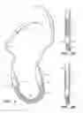 Fig. 02 - BRIDGE CLIP TISSUE CONNECTOR APPARATUS AND METHODS