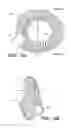 Fig. 03 - BRIDGE CLIP TISSUE CONNECTOR APPARATUS AND METHODS