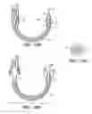 Fig. 13 - BRIDGE CLIP TISSUE CONNECTOR APPARATUS AND METHODS