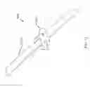 Fig. 13 - Sutureless vascular anastomosis connection