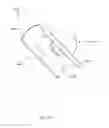 Fig. 35 - Sutureless vascular anastomosis connection