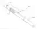 Fig. 01 - Sutureless vascular anastomosis connection