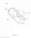 Fig. 35 - Sutureless vascular anastomosis connection