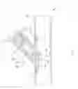 Fig. 02 - Sutureless vascular anastomosis connection