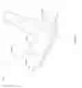 Fig. 30 - Sutureless vascular anastomosis connection