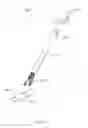 Fig. 33 - Sutureless vascular anastomosis connection