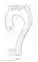 Fig. 02 - Introducer assembly and dilator tip therefor