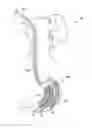 Fig. 01 - Method and apparatus for treating obesity and controlling weight gain using self-expanding intragastric devices