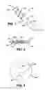 Fig. 02 - Cannula system and method for partial thickness rotator cuff repair