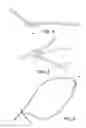 Fig. 03 - Adjustable suture-button construct for ankle syndesmosis repair
