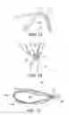 Fig. 07 - Adjustable suture-button construct for ankle syndesmosis repair
