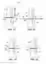 Fig. 09 - Adjustable suture-button construct for ankle syndesmosis repair