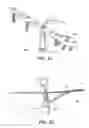 Fig. 10 - Adjustable suture-button construct for ankle syndesmosis repair
