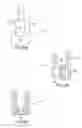 Fig. 05 - Spinal stabilization systems and methods