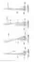 Fig. 41 - Spinal stabilization systems and methods