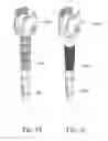 Fig. 06 - BONE FIXATION DEVICE