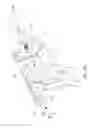 Fig. 26 - BONE FIXATION DEVICE