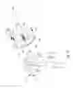 Fig. 27 - BONE FIXATION DEVICE
