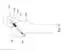 Fig. 29 - BONE FIXATION DEVICE