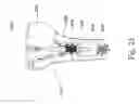 Fig. 31 - BONE FIXATION DEVICE