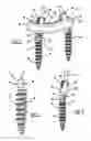 Fig. 02 - Method for placement of a pedicle screw and rod system