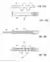 Fig. 07 - Bone implant and systems that controllably releases silver