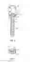 Fig. 11 - Spinal instruments with set screw loading and retention apparatus and methods of use