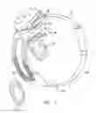 Fig. 02 - Visual prosthesis with an improved electrode array adapted for foveal stimulation