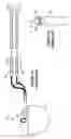 Fig. 02 - External trial stimulator useable in an implantable neurostimulator system