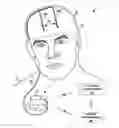 Fig. 01 - PATIENT PROGRAMMER WITH CUSTOMIZABLE PROGRAMMING