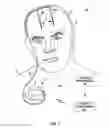 Fig. 02 - PATIENT PROGRAMMER WITH CUSTOMIZABLE PROGRAMMING