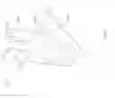 Fig. 22 - SUTURELESS VASCULAR ANASTOMOSIS CONNECTION