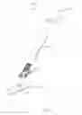 Fig. 32 - SUTURELESS VASCULAR ANASTOMOSIS CONNECTION