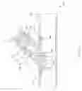 Fig. 02 - Sutureless vascular anastomosis connection