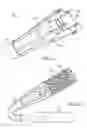 Fig. 02 - System and method for removing an implanted object in a passageway in a patient