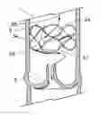 Fig. 01 - Flow-deflecting medical device