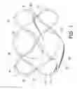 Fig. 02 - Flow-deflecting medical device