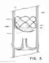 Fig. 06 - Flow-deflecting medical device