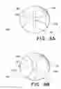 Fig. 09 - Flow-deflecting medical device