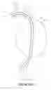 Fig. 09 - THORACIC AORTIC STENT STRUCTURE