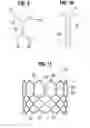 Fig. 04 - Prosthetic heart valve