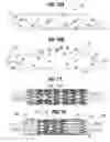 Fig. 06 - Prosthetic heart valve
