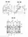 Fig. 07 - Prosthetic heart valve