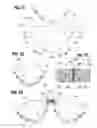 Fig. 08 - Prosthetic heart valve
