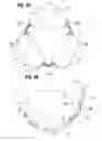 Fig. 09 - Prosthetic heart valve