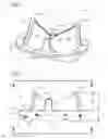 Fig. 02 - Prosthetic heart valve with dissimilar leaflets