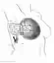 Fig. 01 - Methods and systems for breast reconstruction